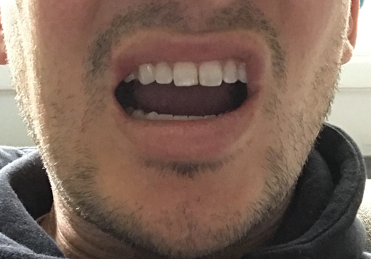 Utah Oral Surgery & Dental Implant Center photo 2