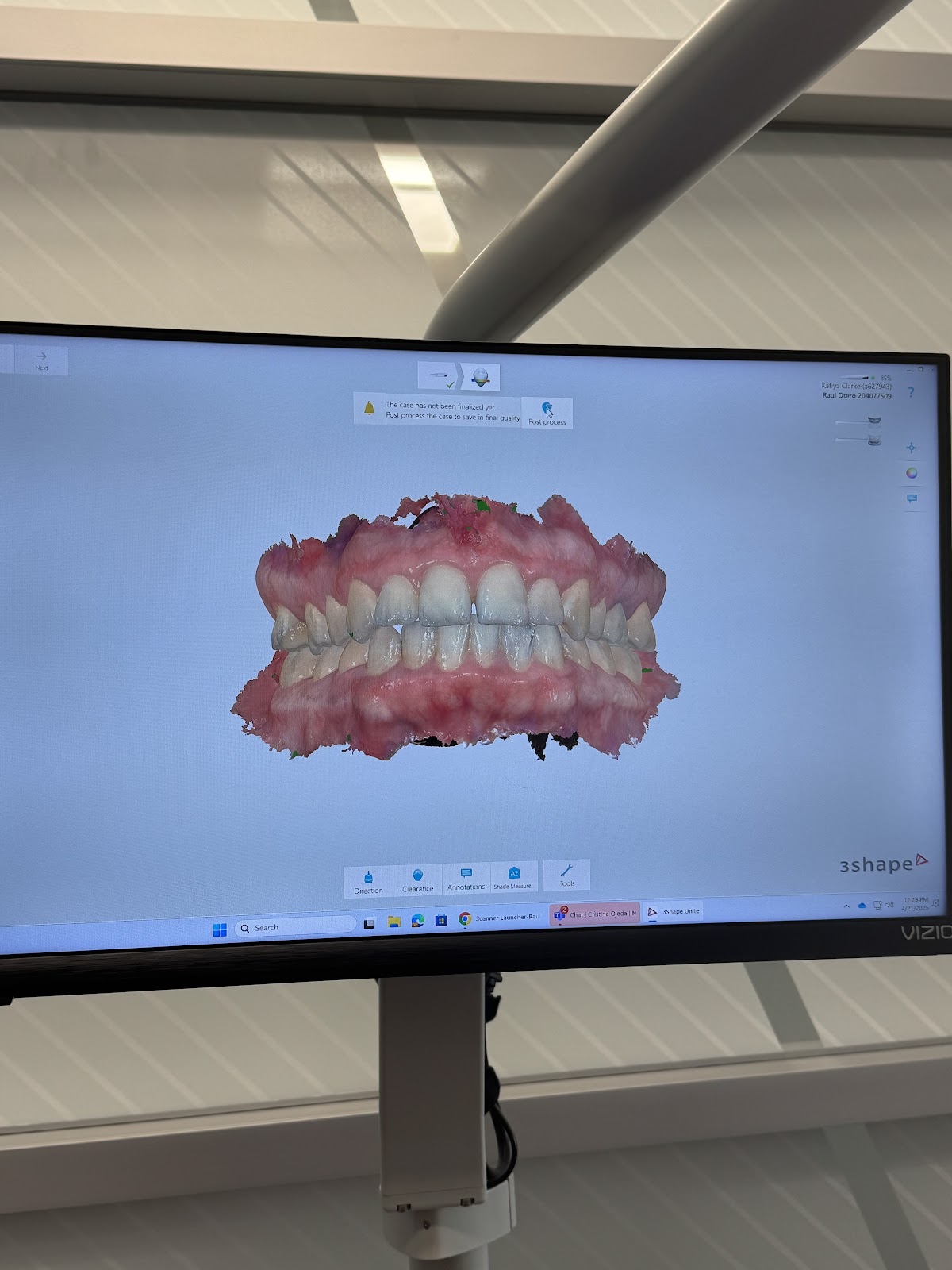 Aspen Dental - Laurel photo 1