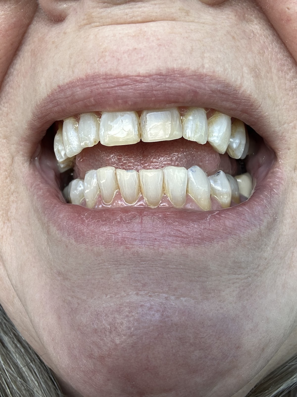 Advanced Family Dentistry photo 4