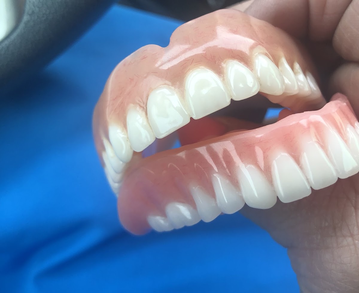 Affordable Dentures & Implants - Commerce photo 5