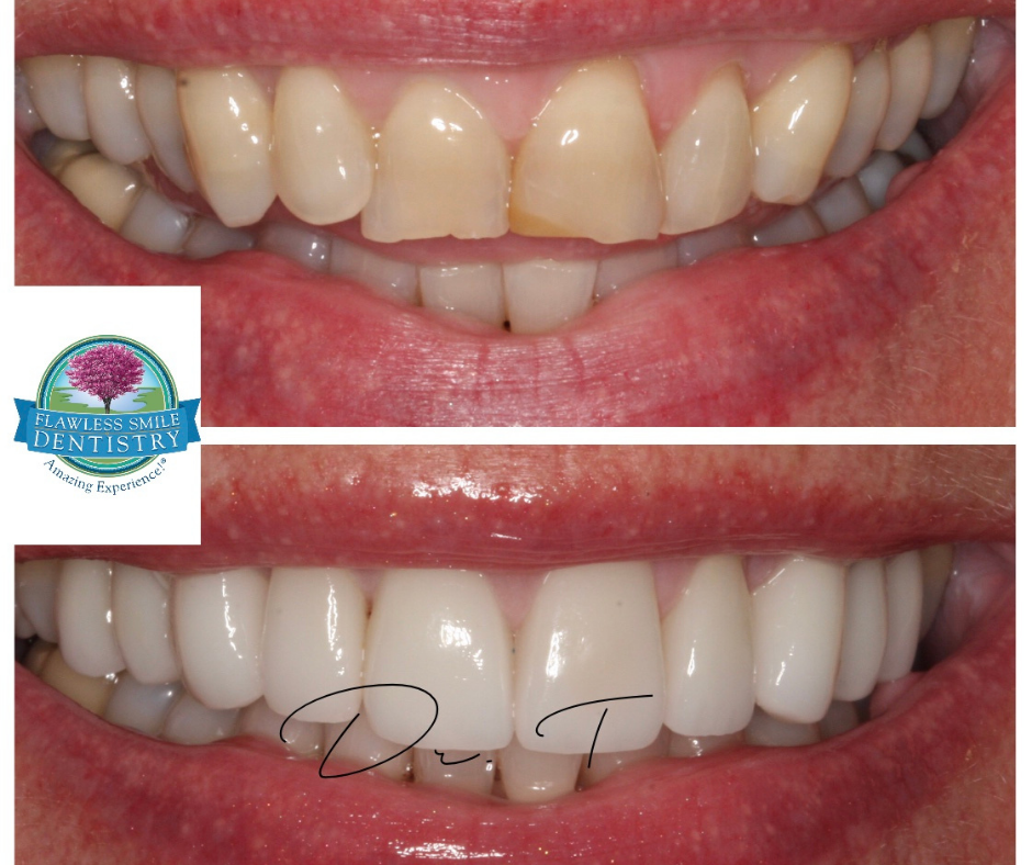 Flawless Smile Dentistry Broken Arrow photo 4