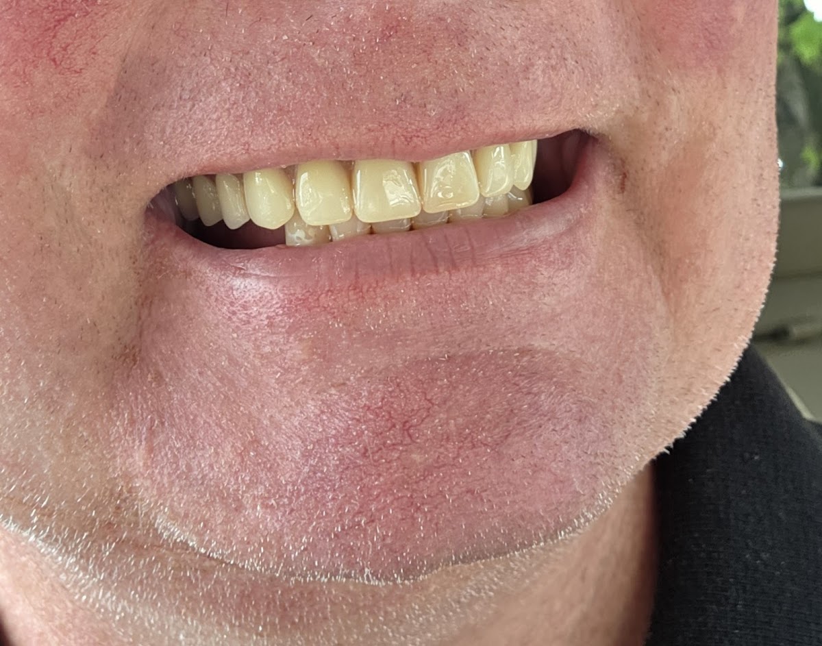 Aspen Dental - Greenwood photo 4