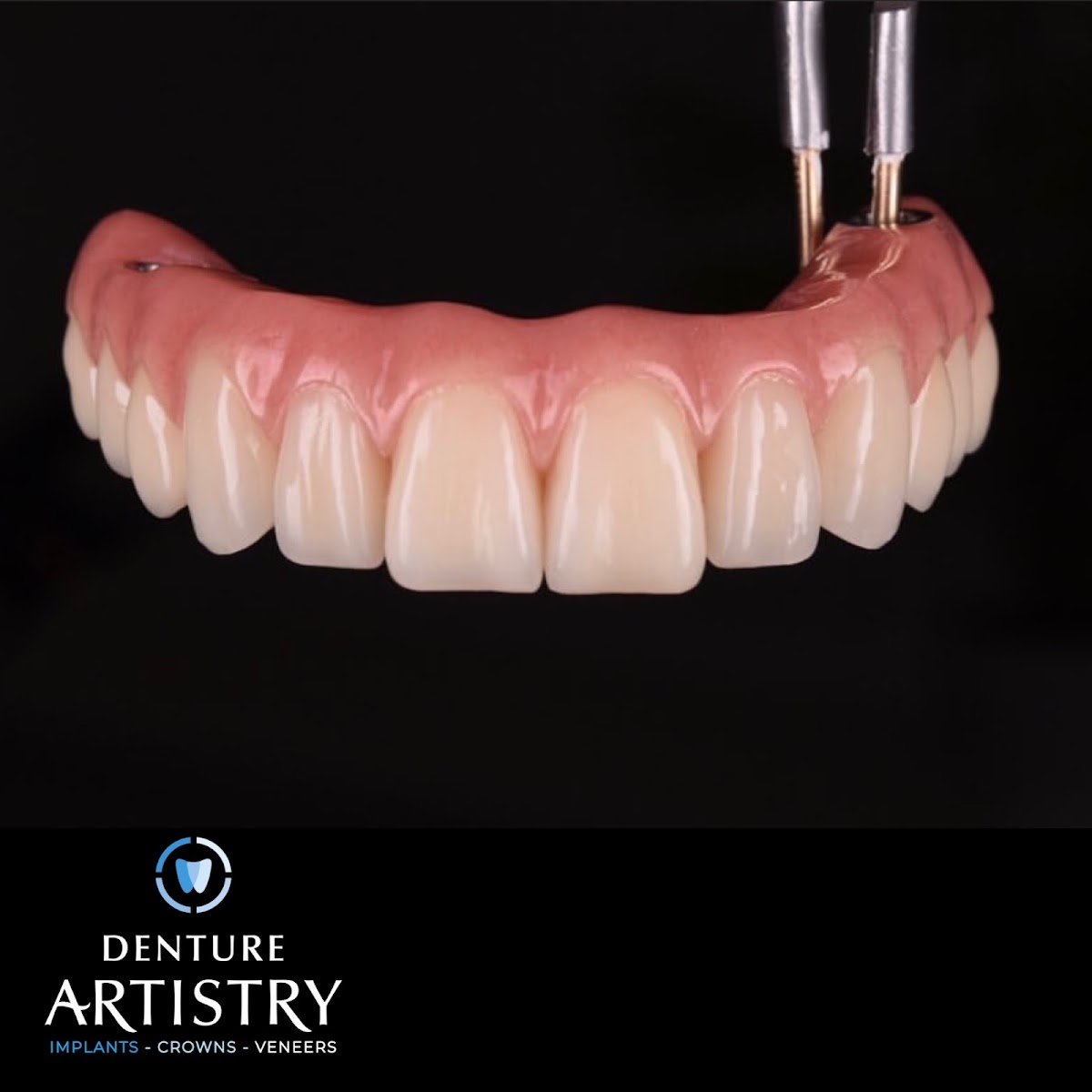 Dental Artistry Implants - Crowns - Veneers photo 2