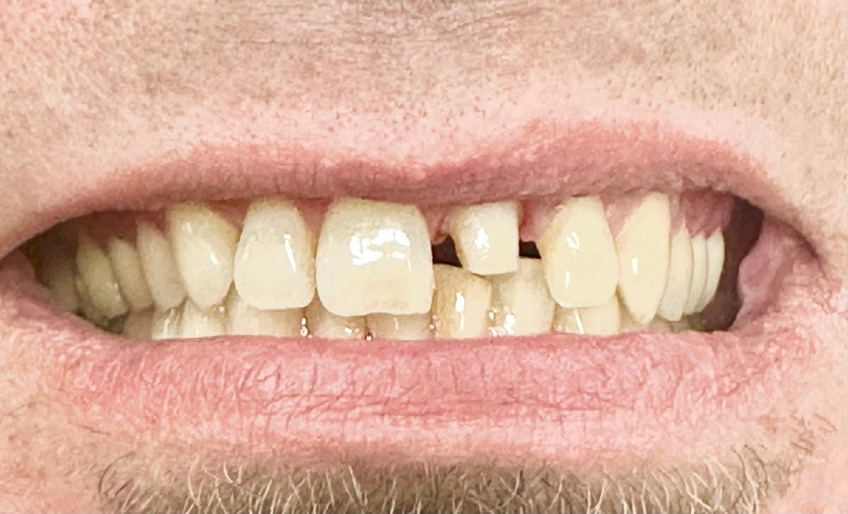 La Verne Dental & Implant Center photo 2