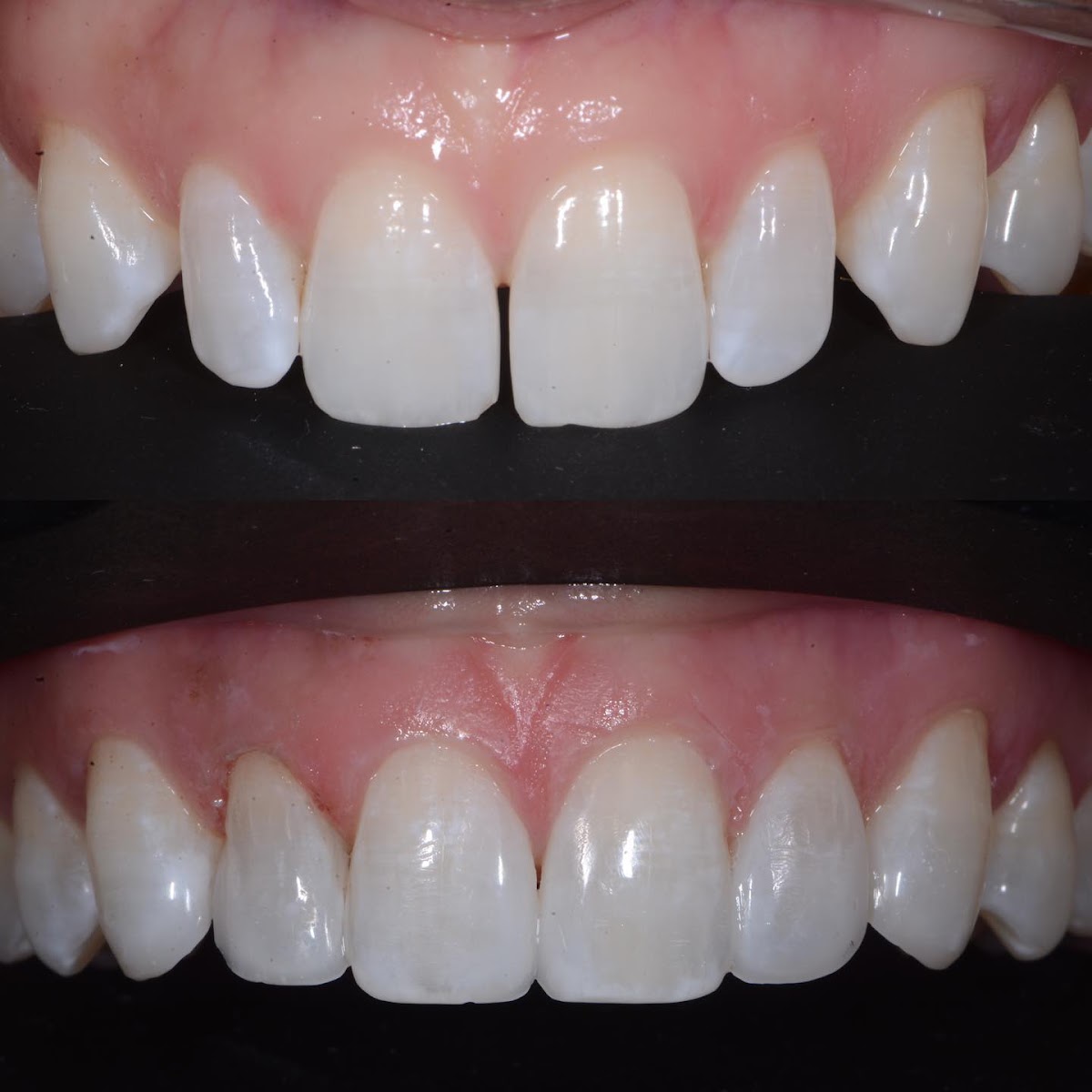 South Glens Falls Family Dentistry photo 4