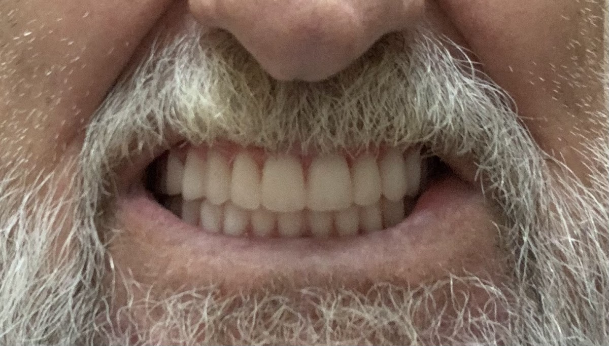 Affordable Dentures & Implants - Georgetown photo 3