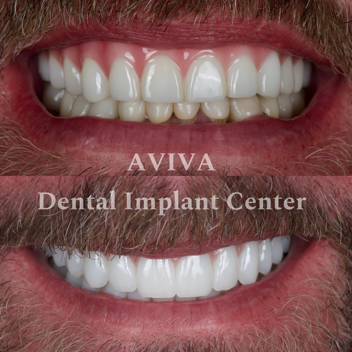 Aviva Dental Implant Center photo 3