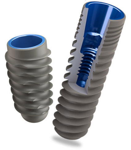 Ihex Implants photo 1