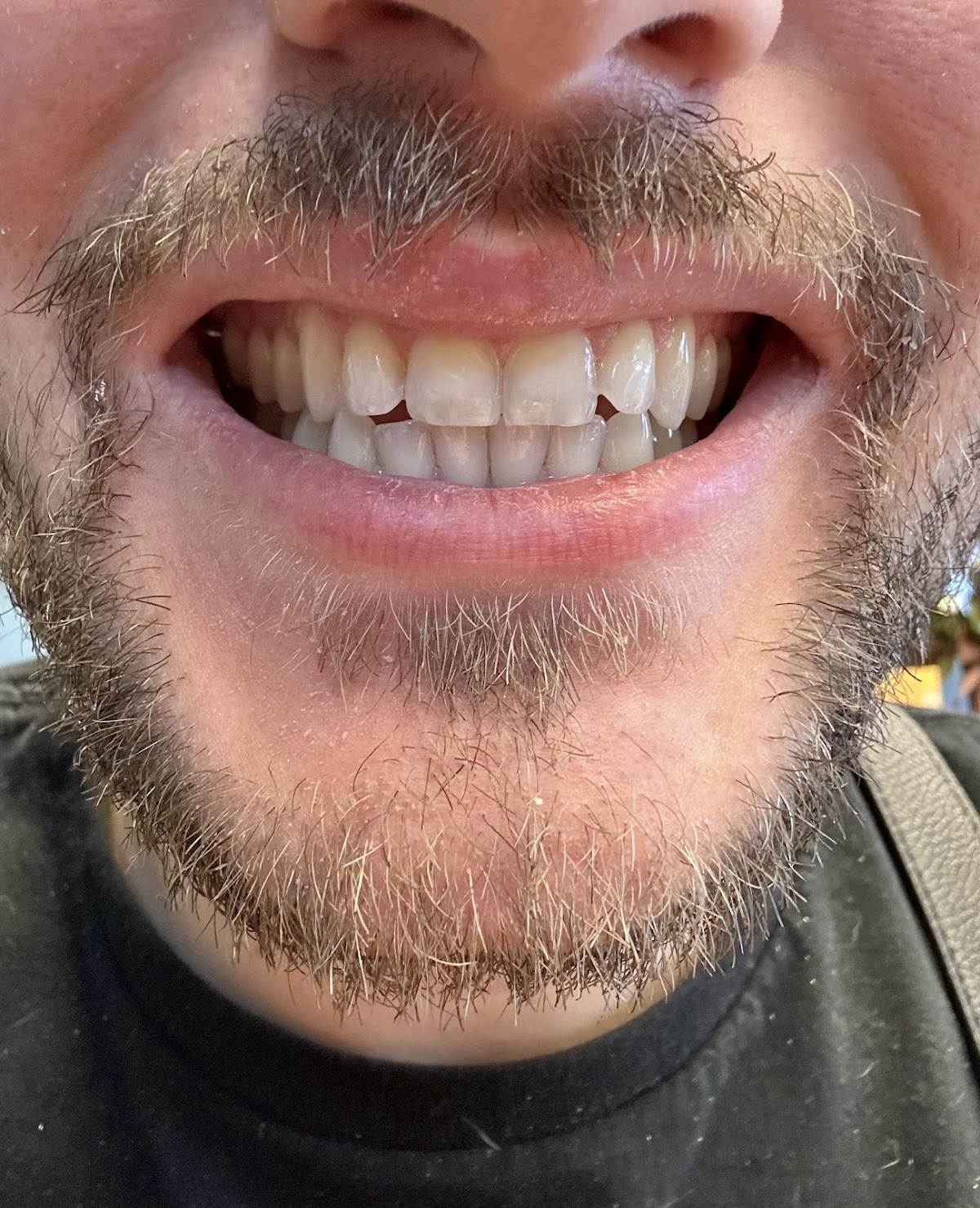 Arnold Family Dentistry photo 3
