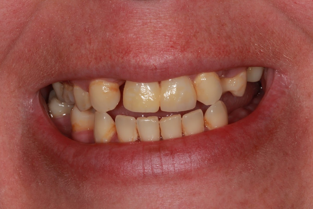 Frontier Family Dental photo 2