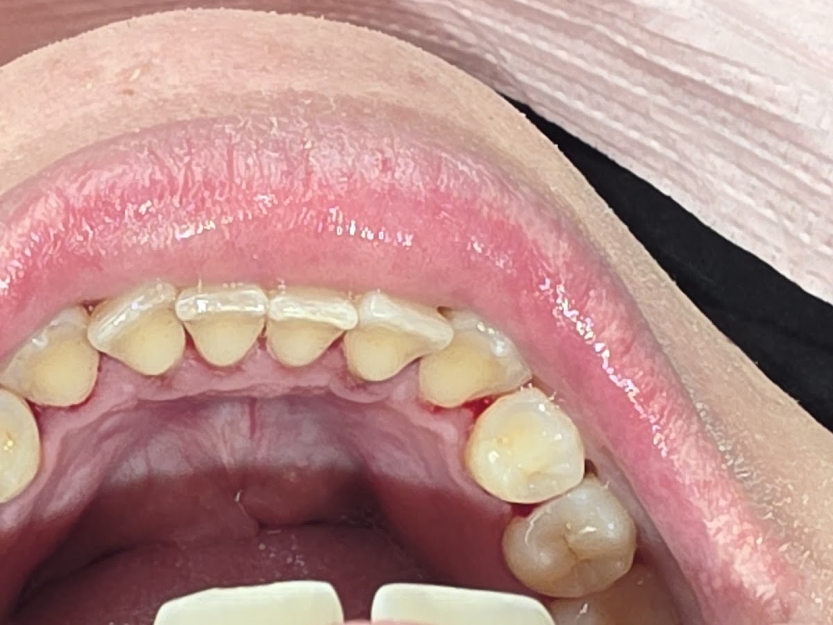 Access Dental, Dentures & Implants photo 1