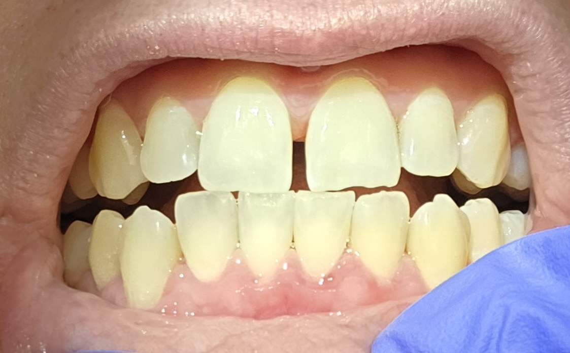 Access Dental, Dentures & Implants photo 4