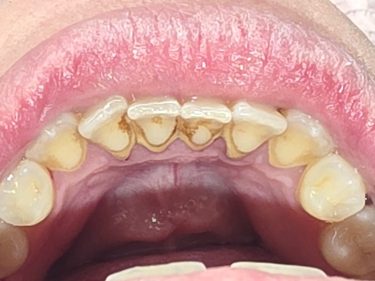 Access Dental, Dentures & Implants photo 6