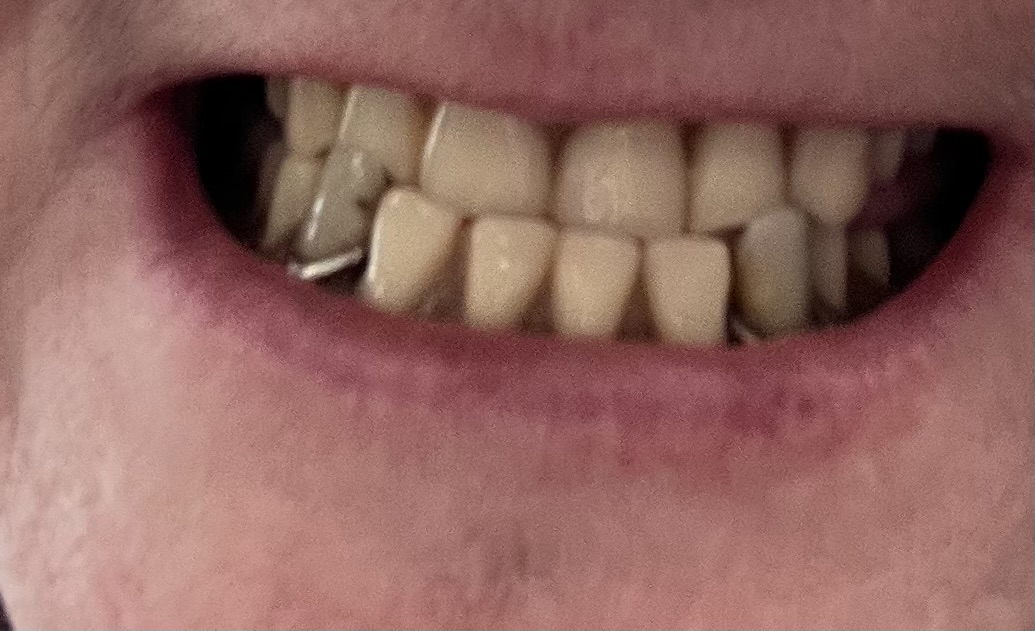 Affordable Dentures & Implants - Olive Branch photo 6