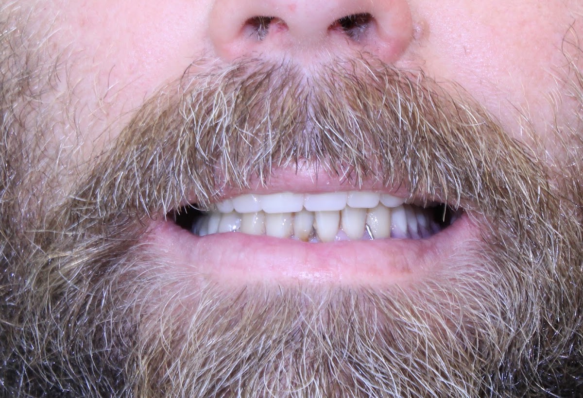 Wallace Family Dental photo 6
