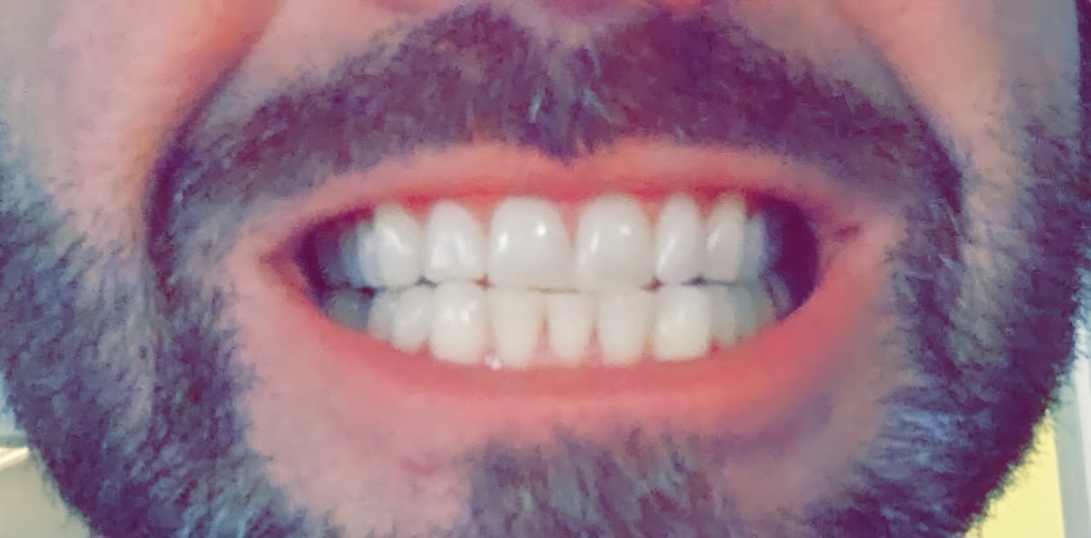 Gbr Dental photo 3