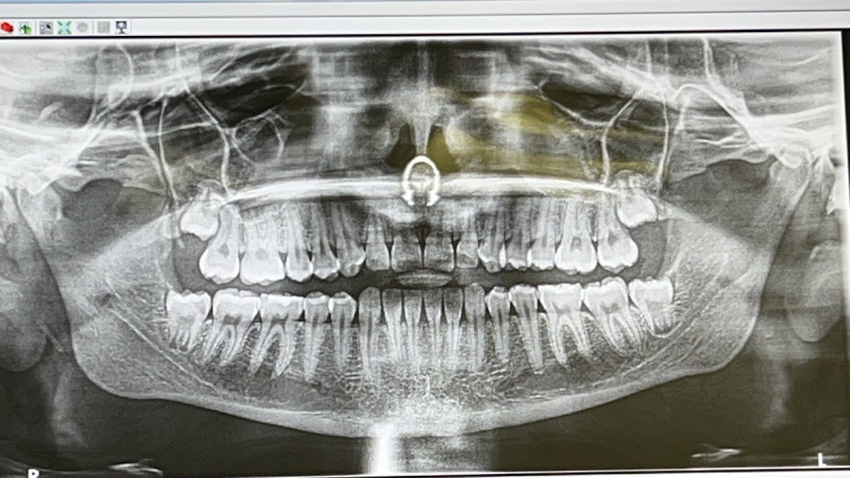 Amherst Oral Surgery and Implant Center photo 2