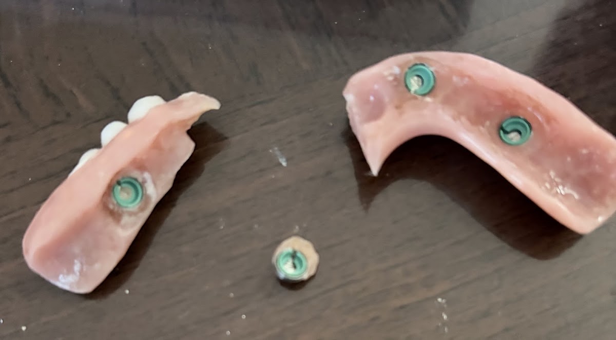 Affordable Dentures & Implants - Newport News photo 3