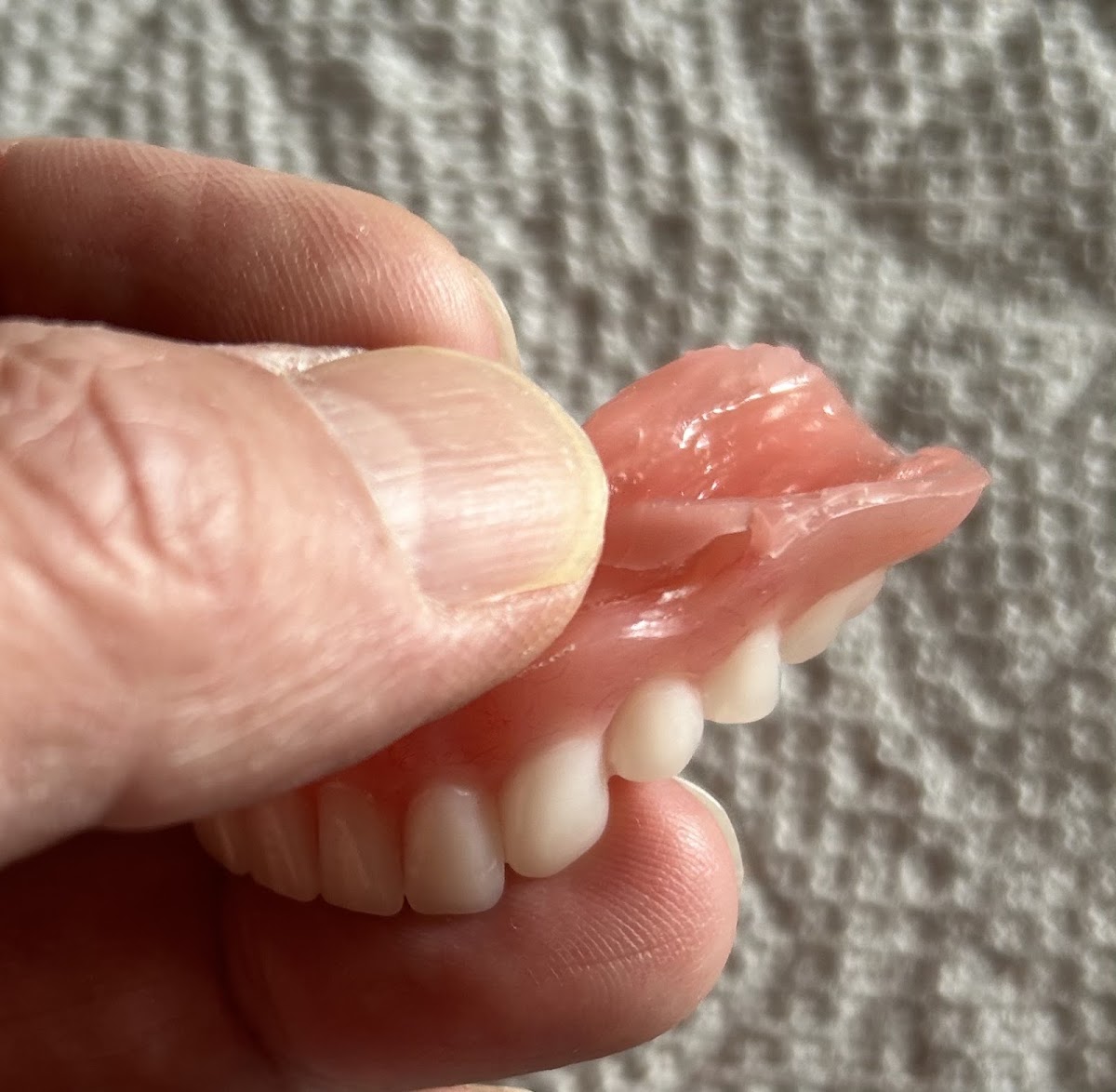 Affordable Dentures & Implants - Newport News photo 6