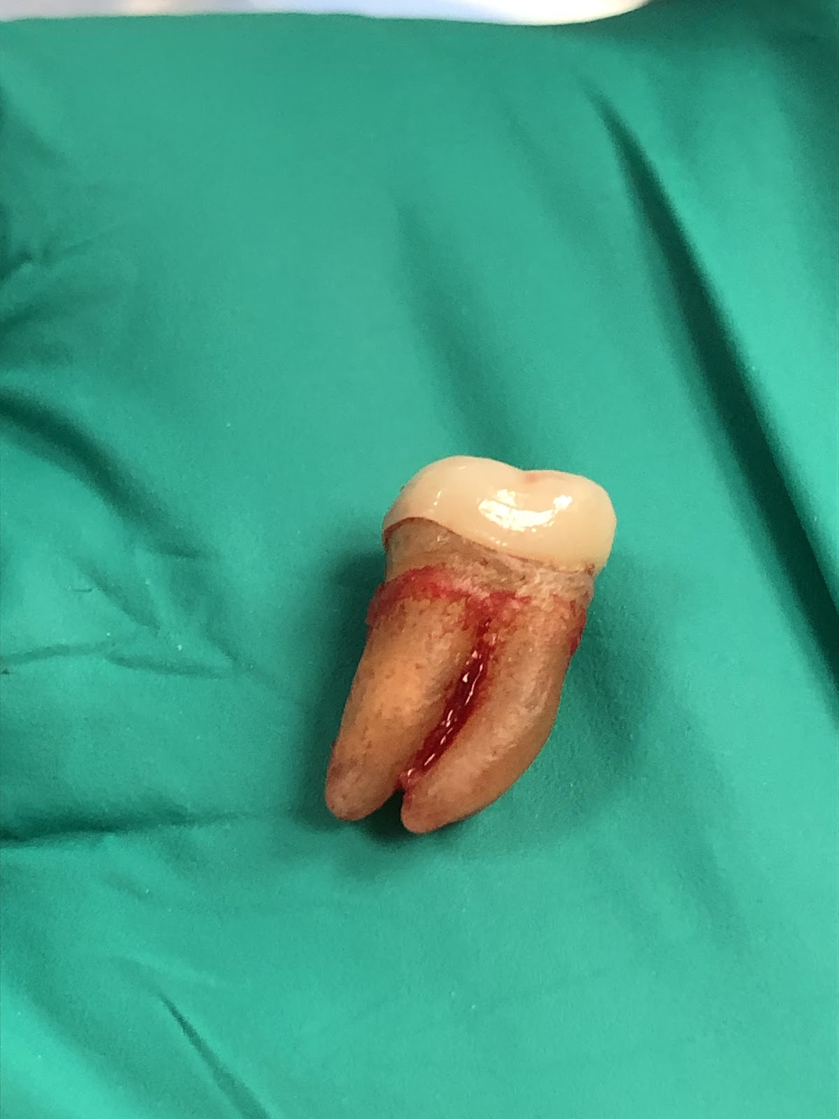 Affordable Dentures & Implants - Stone Mountain photo 3