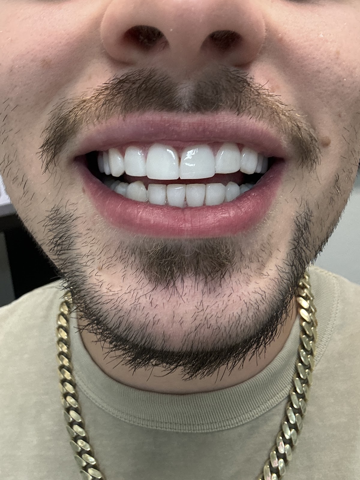 Smile Makers Pro photo 1