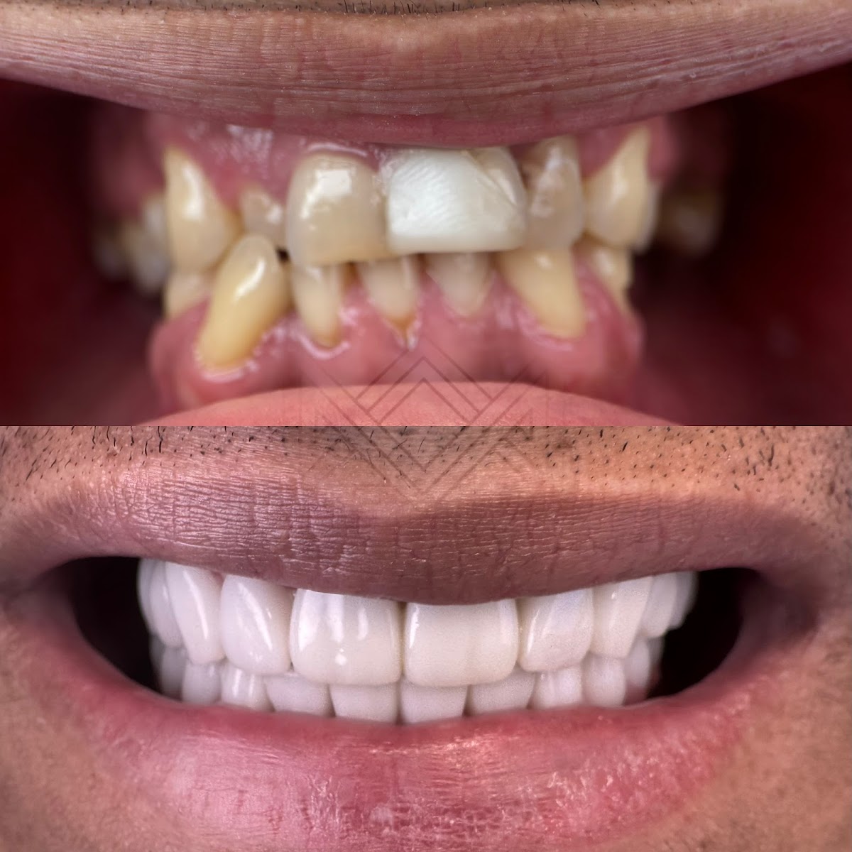 Crown Dental photo 2