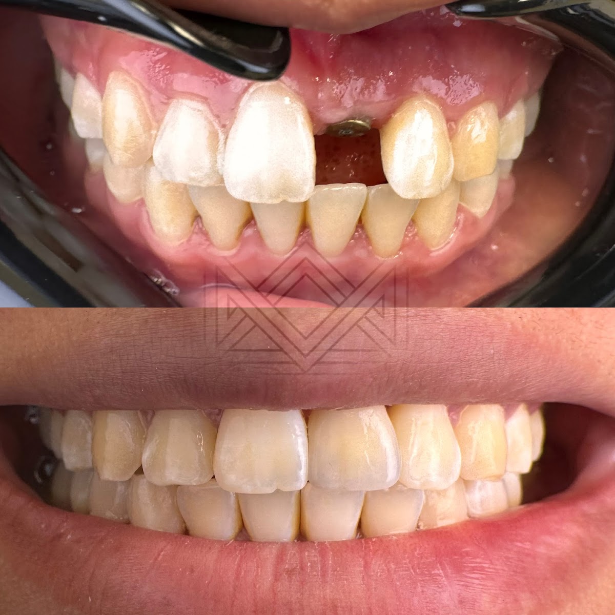 Crown Dental photo 4
