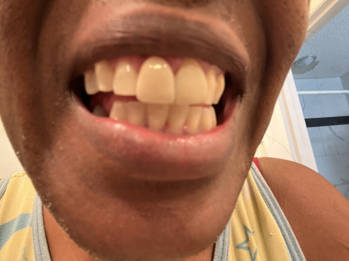 Affordable Dentures & Implants - Spartanburg photo 3