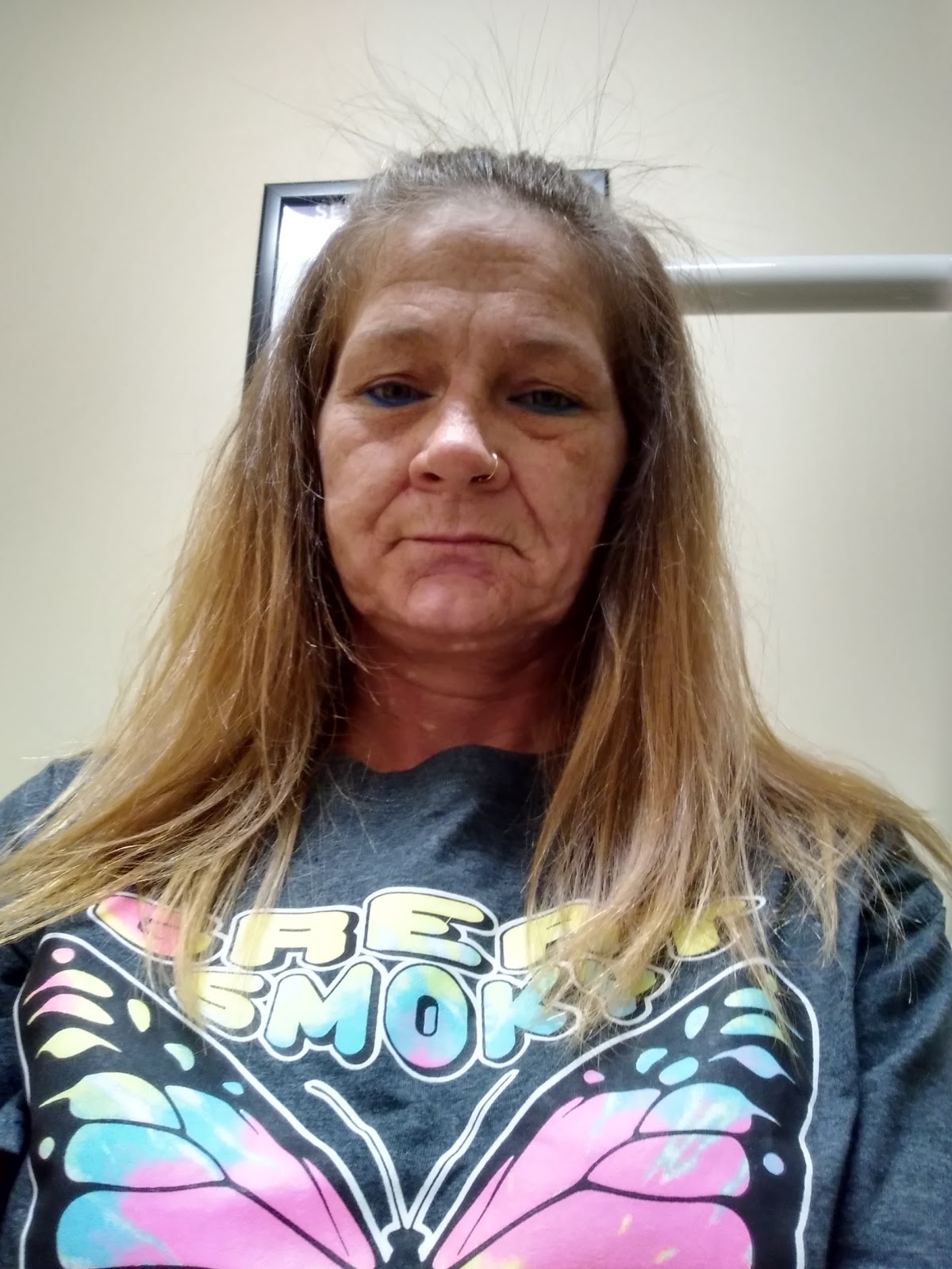 Affordable Dentures & Implants - Jeffersonville photo 6