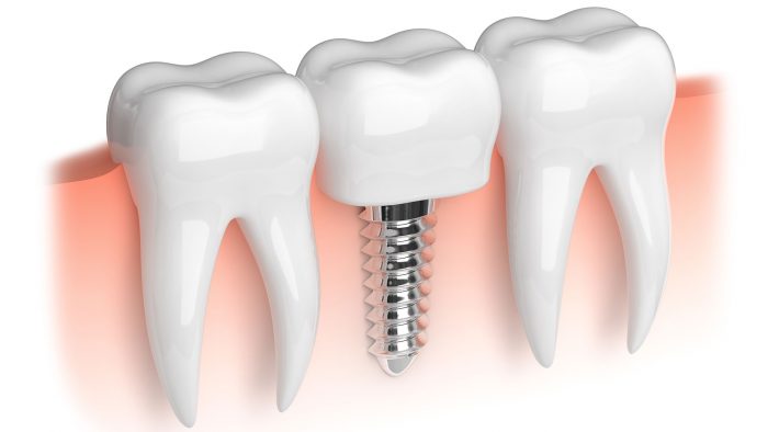 Island Dental photo 1