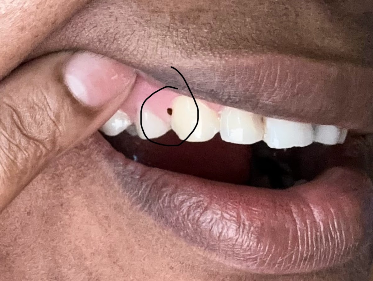 Affordable Dentures & Implants - Harrisburg photo 5