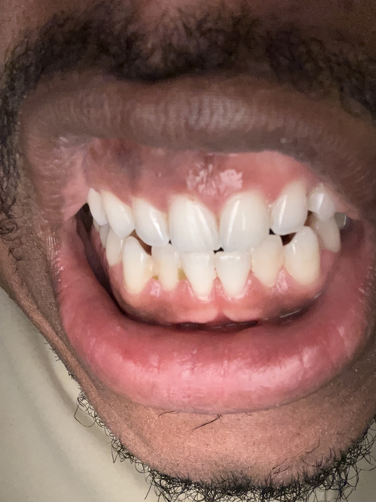 Aspen Dental - Dekalb photo 4