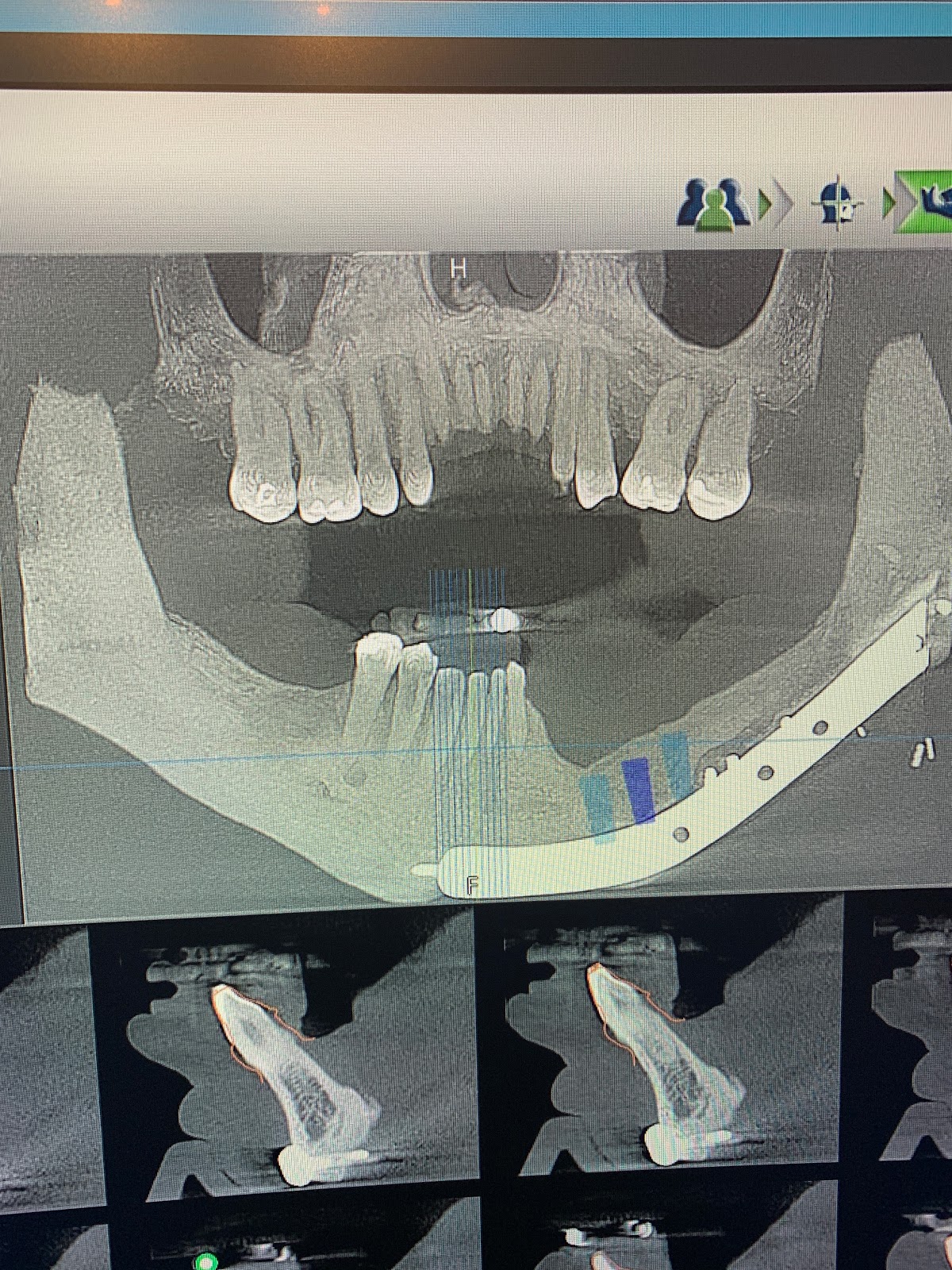 Parkway Oral Surgery and Dental Implant Center photo 5