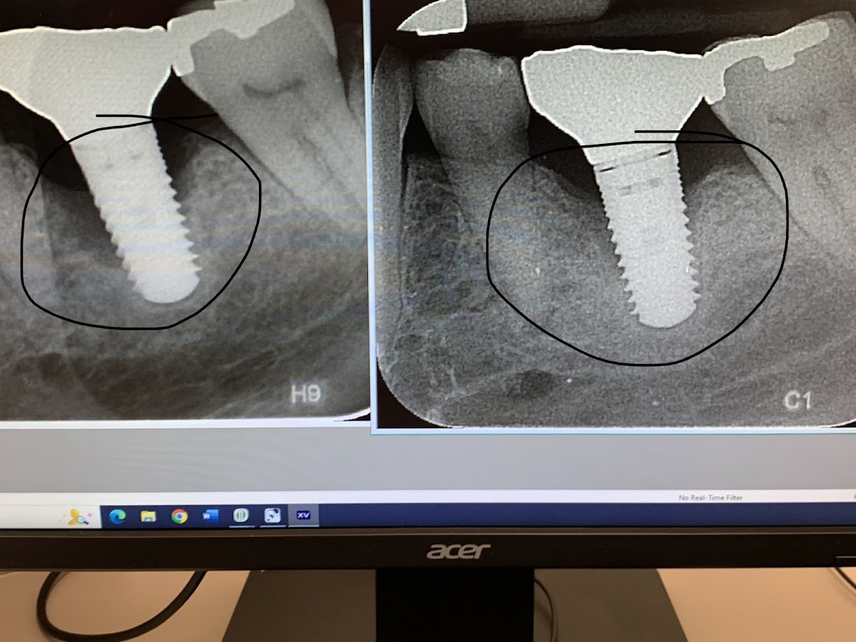 Idaho Perio Center for Dental Implants and Laser Periodontal Therapy. photo 1