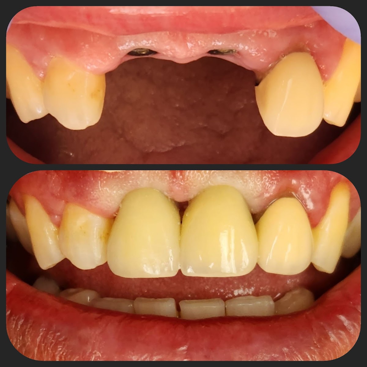Affordable Dental Implants Long Island photo 6
