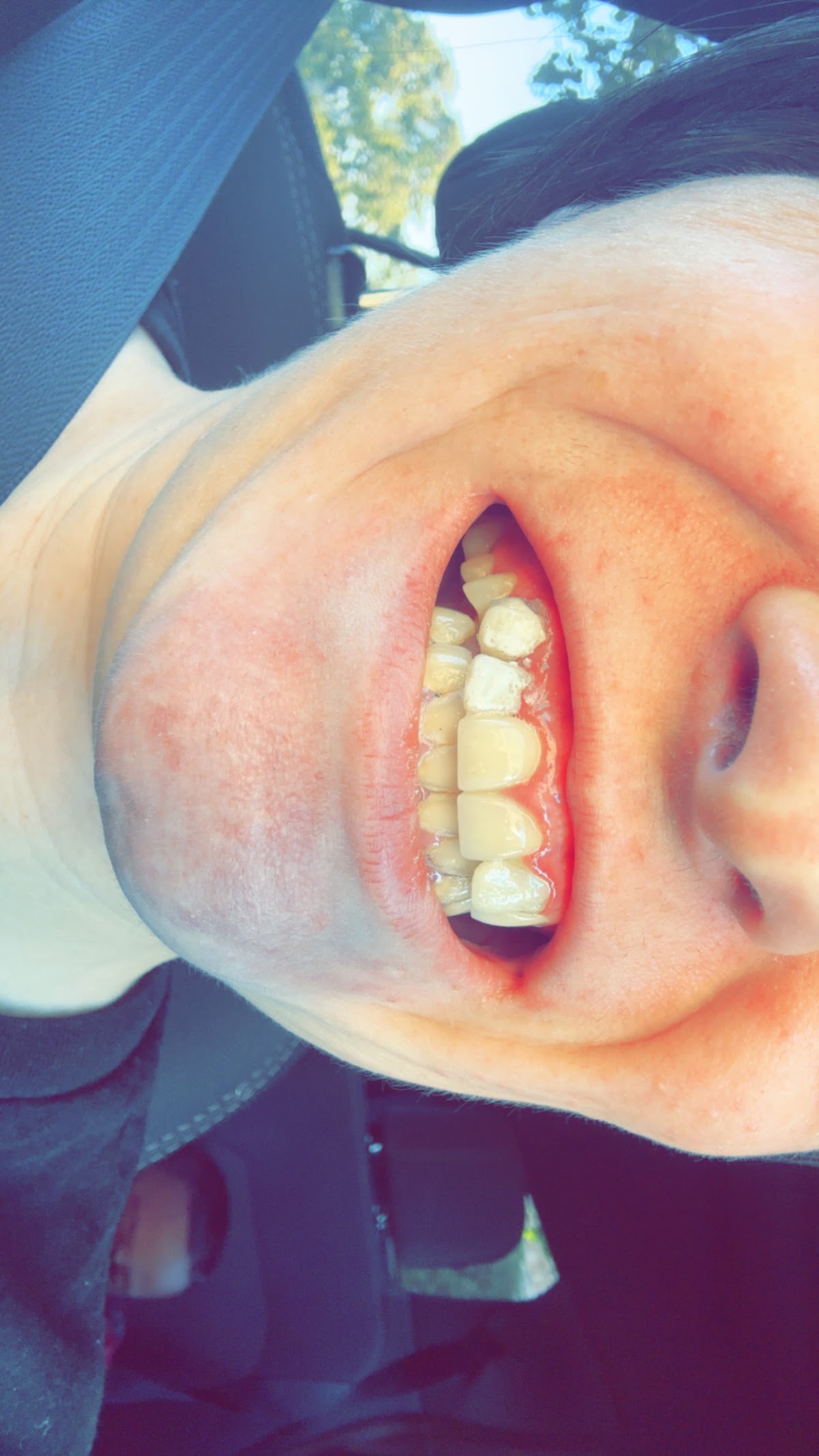 Aspen Dental - Grand Prairie photo 6