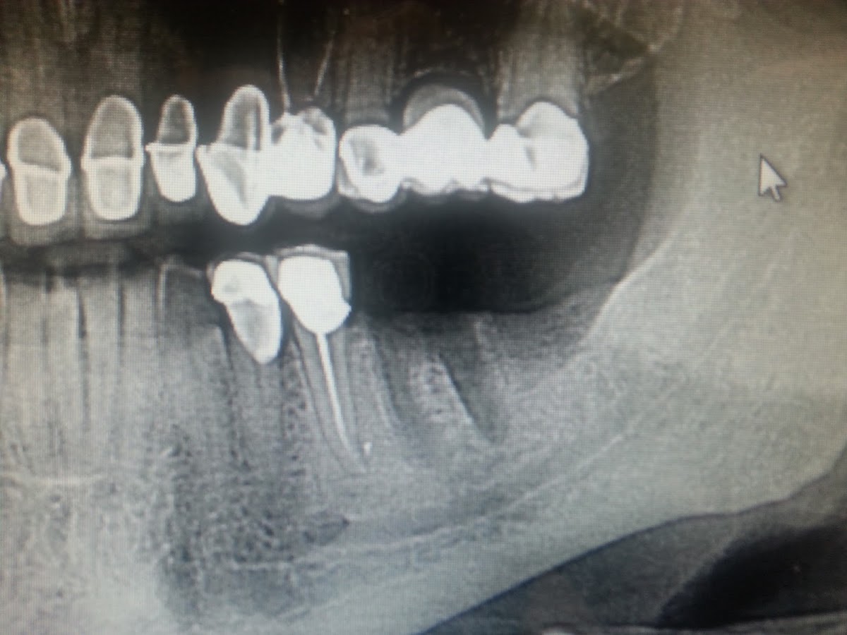 Affordable General Dentistry & Implants photo 1