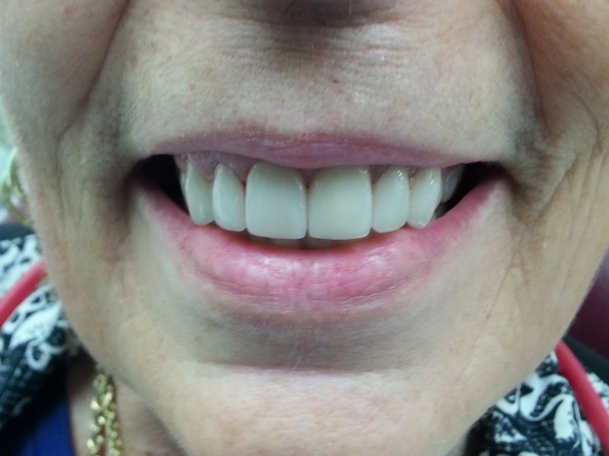 Affordable General Dentistry & Implants photo 4