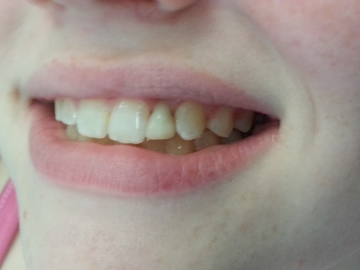 Affordable General Dentistry & Implants photo 5