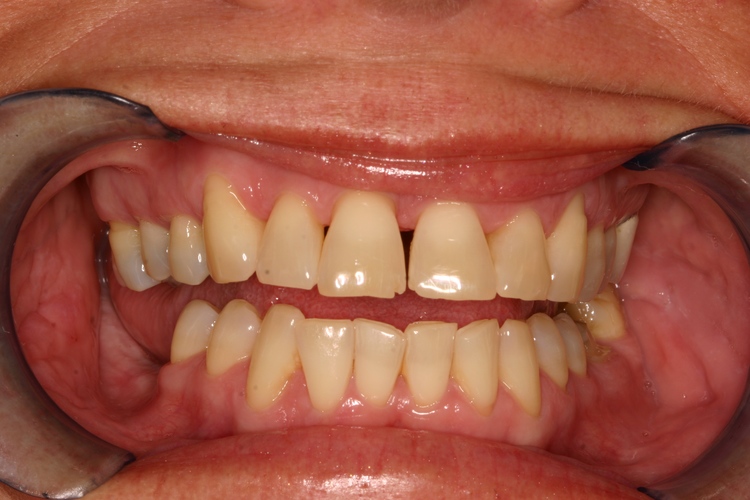 Murrieta Smiles Dentistry photo 1
