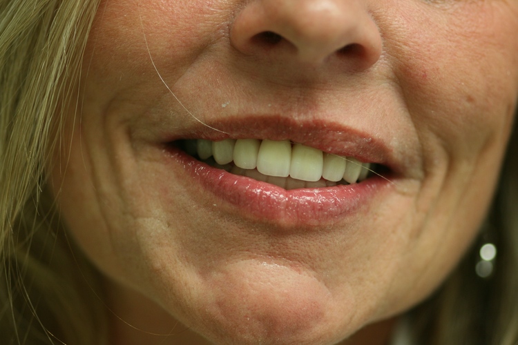 Murrieta Smiles Dentistry photo 5