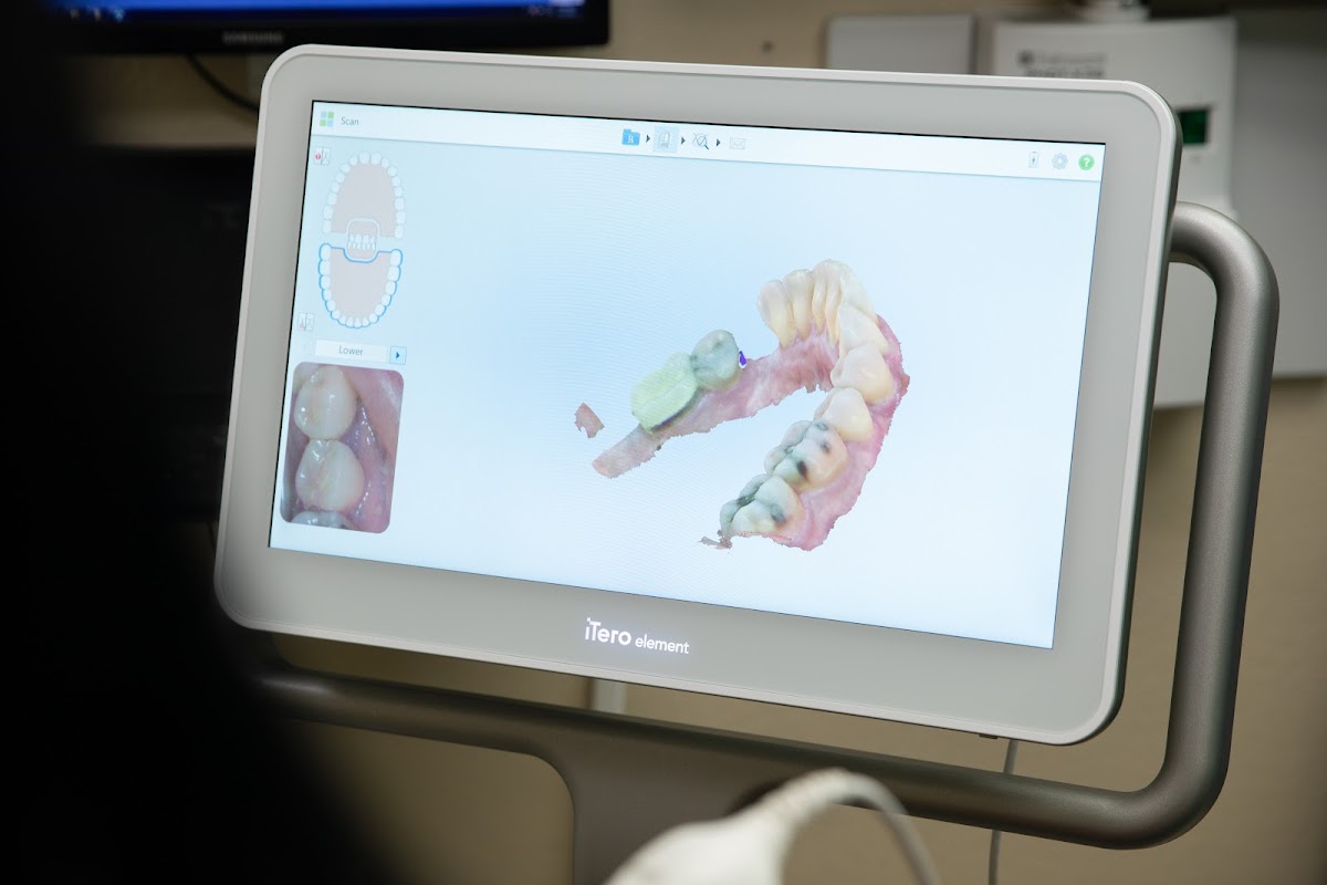 Phoenix Implant Clinic | Dr. Eddie Harsini, DDS All on 4 photo 5