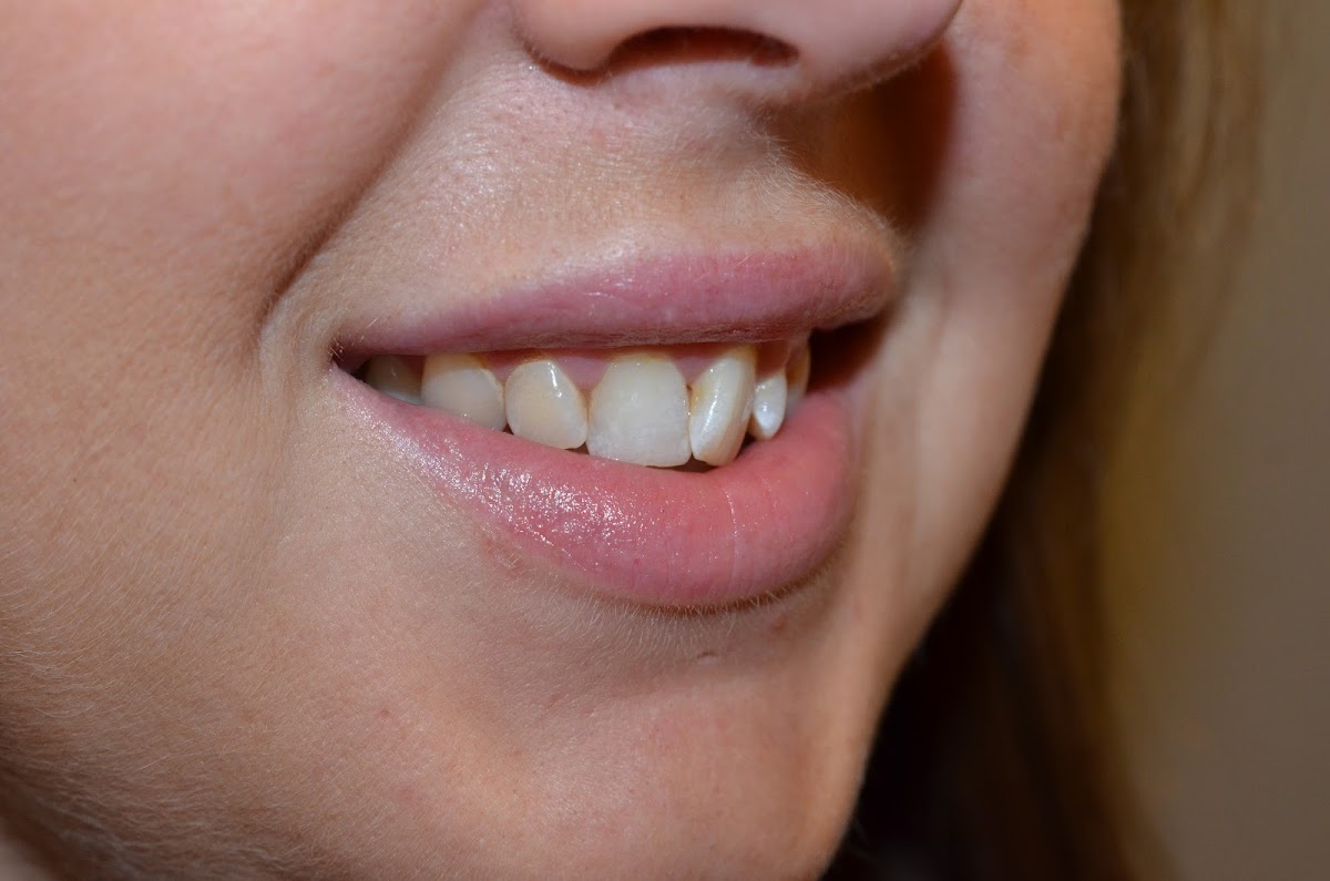 Olympia Smiles Dentistry for All Ages photo 3