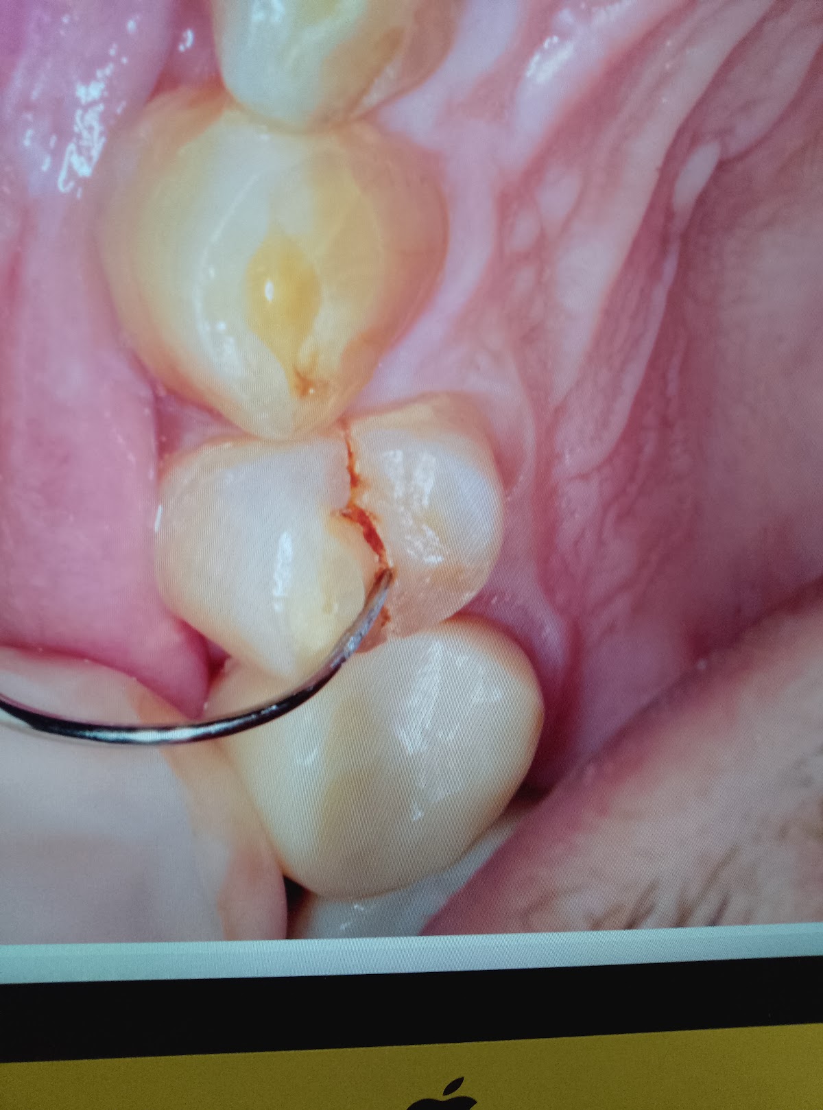 Aspen Dental - Halethorpe photo 4