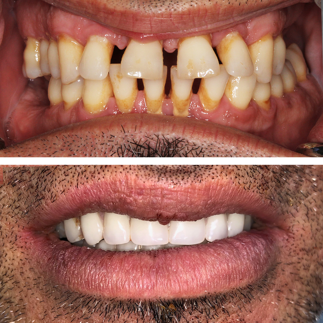 New Teeth Now photo 3