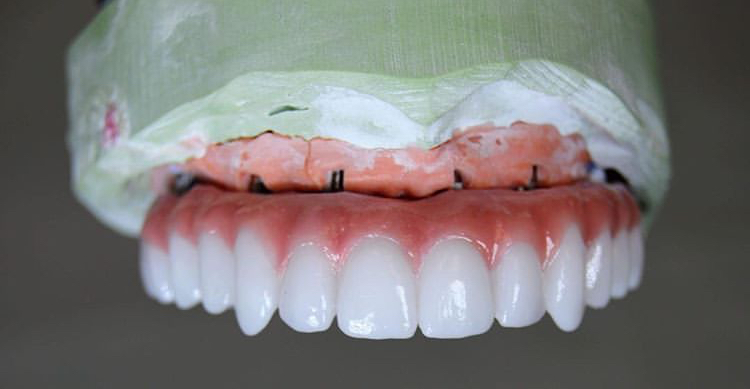 New Teeth Now photo 6