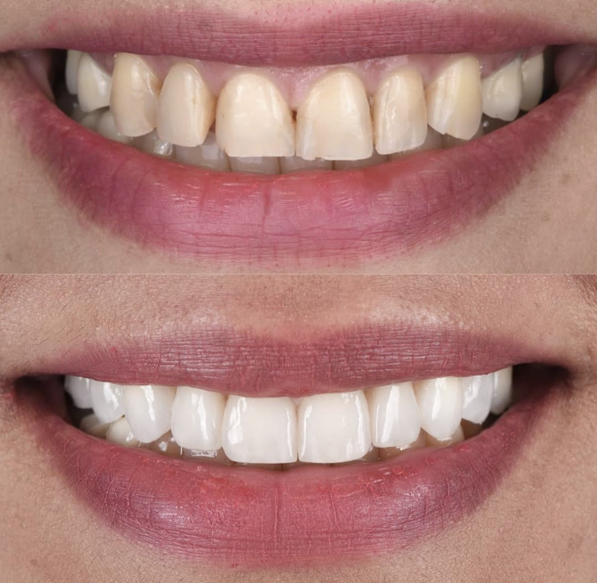 New Smiles Dental Implant Center photo 1