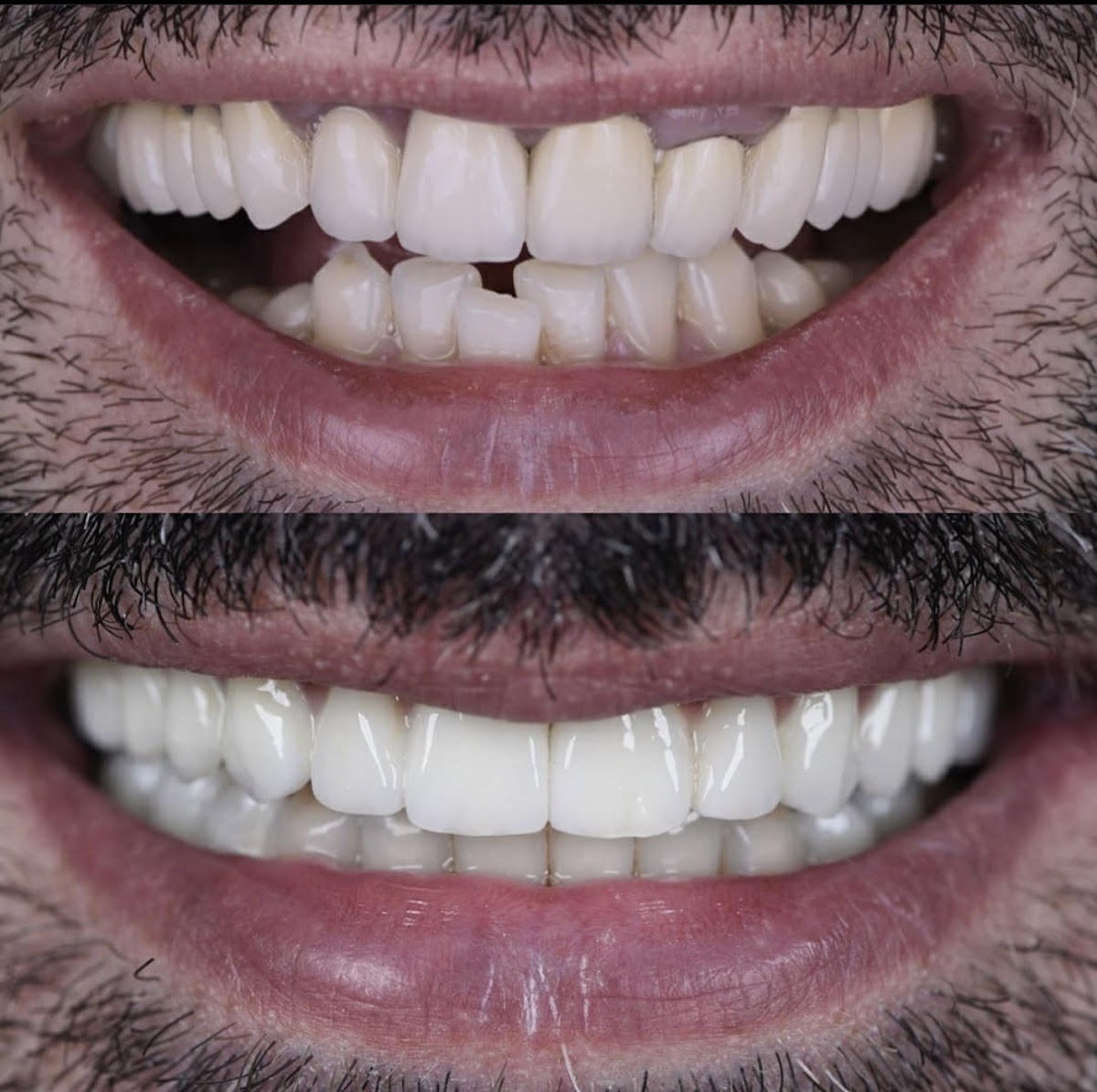 New Smiles Dental Implant Center photo 4