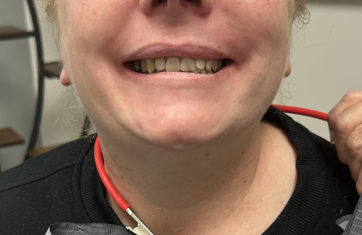 Indiana Emergency Dental Bloomington photo 5