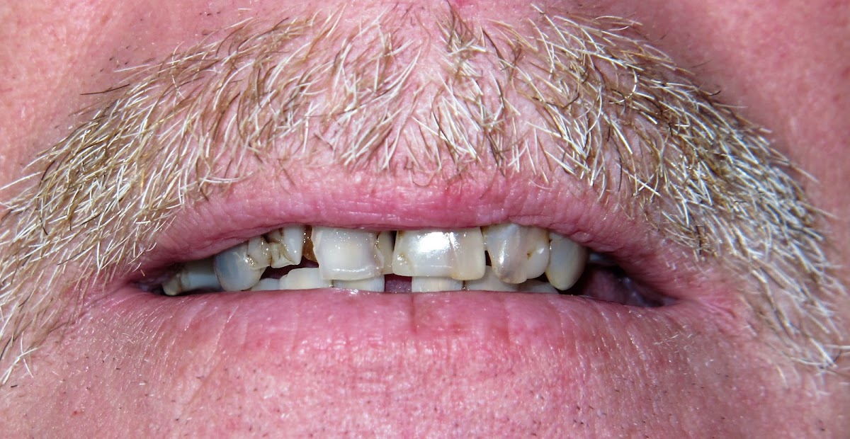 Mini Dental Implant Center photo 1